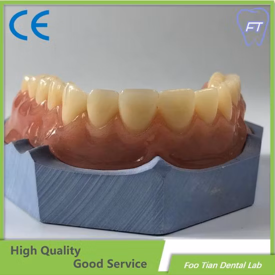 Orthodontics Study Model Removable Denture