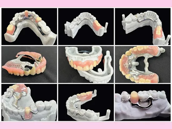 Dental Lab Outsourcing Full Services Dental Agency Reliable Partner OEM Partial Dentures with Metal Framework and Acrylic Teeth