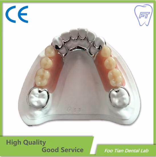 Cast Partial Framework Removable Denture Dental