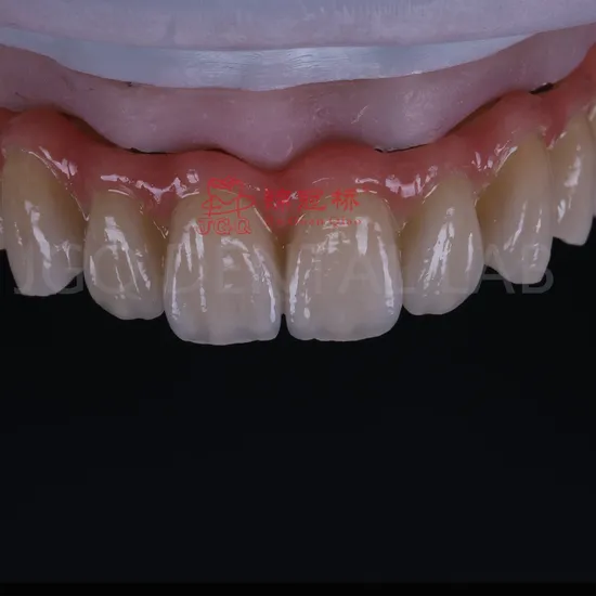 Factory Implanted Teeth Best Affordable Price China Dental Implants Titanium Base and Zirconia Crown for Dental Clinics
