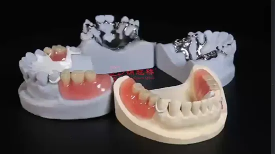 Dental Lab Customize Metal Removable Full Arch Dentures on Milled Titanium Partial Framework