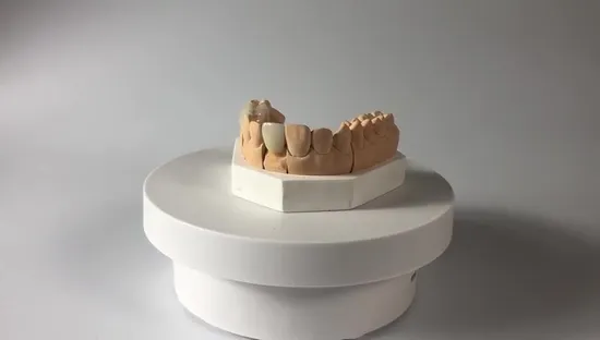 Dental Material Lab Implant Dental Lab Custom Full Contour Zirconium Crown Without Porcelain on Selling
