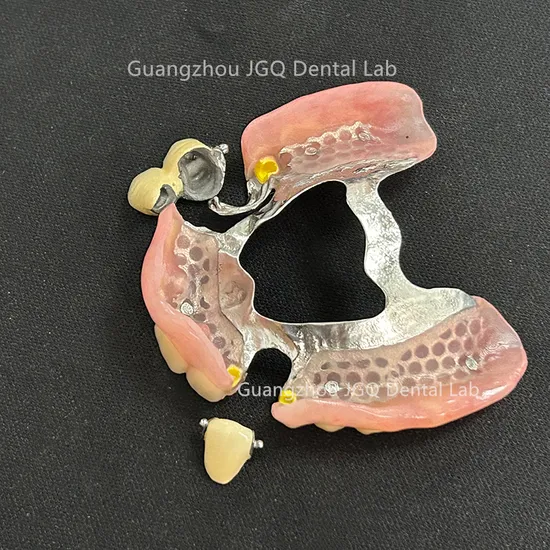 Dental Magnetic Attachment Precision Attachments Removable Partial Denture Without Clasp for Dental Care 