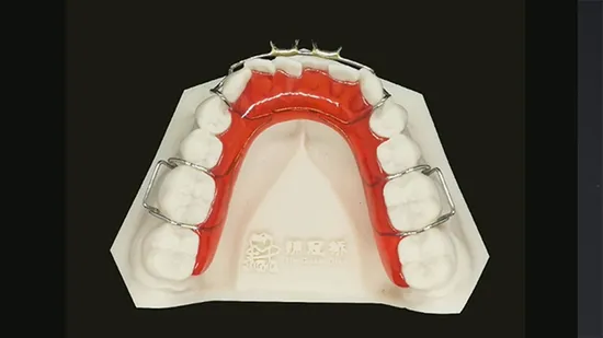 for Dental Clinic for Dentist Dental Laboratory Denture Attachment 3D Metal Printed Partial Removable Denture with Teeth Set up 