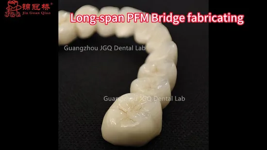 Natural and Realistic Metal Ceramic Crowns Pfm Free Samples Without Metal Band 