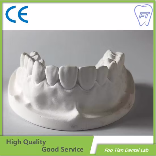 Dental Implant Orthodontics Study Model Removable Denture