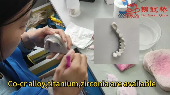 Professional Dental Lab Customize Pfm Ceramic Crowns and Bridges Multilayer Shade 