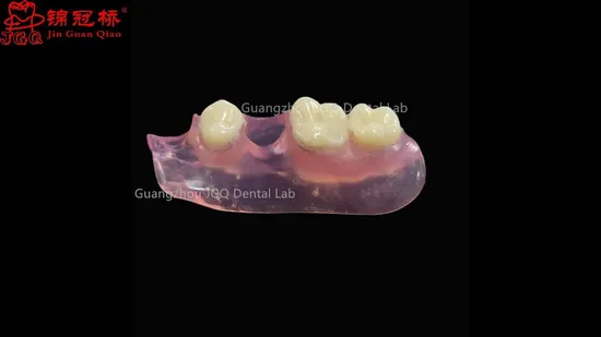 Dental Valplast Flexible Dentures Superior Comfort, Improved Speech, and a Better Fit Than Traditional Dentures Customized Dental Lab 