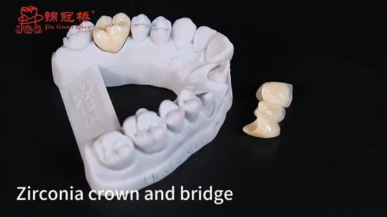 Dental Lab Customize Cast Zirconia Crown and Bridge Solid Stable Zirconia Bridge 