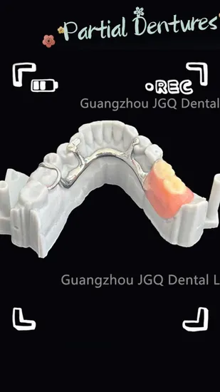 Favorable Price Partial Precision Attachment Teeth Dental Dentures Framework for Full Mouth Removable Dentures 