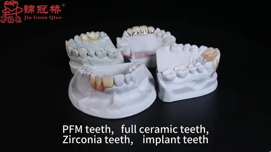 Top Brand Dental Material Metal Ceramic Crown Bridge Pfm Implant Teeth 