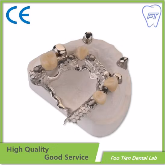 High Quality Orthodontics Study Model Removable Denture
